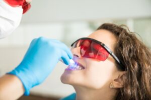 5 Reasons Why You Should Consider Teeth Whitening