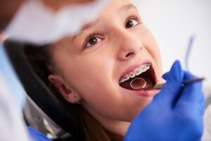 The Ultimate Guide to Contemporary Orthodontic Options