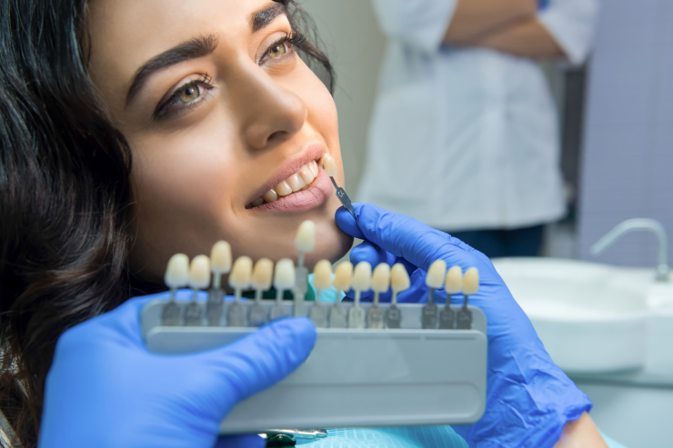 Dental Veneers